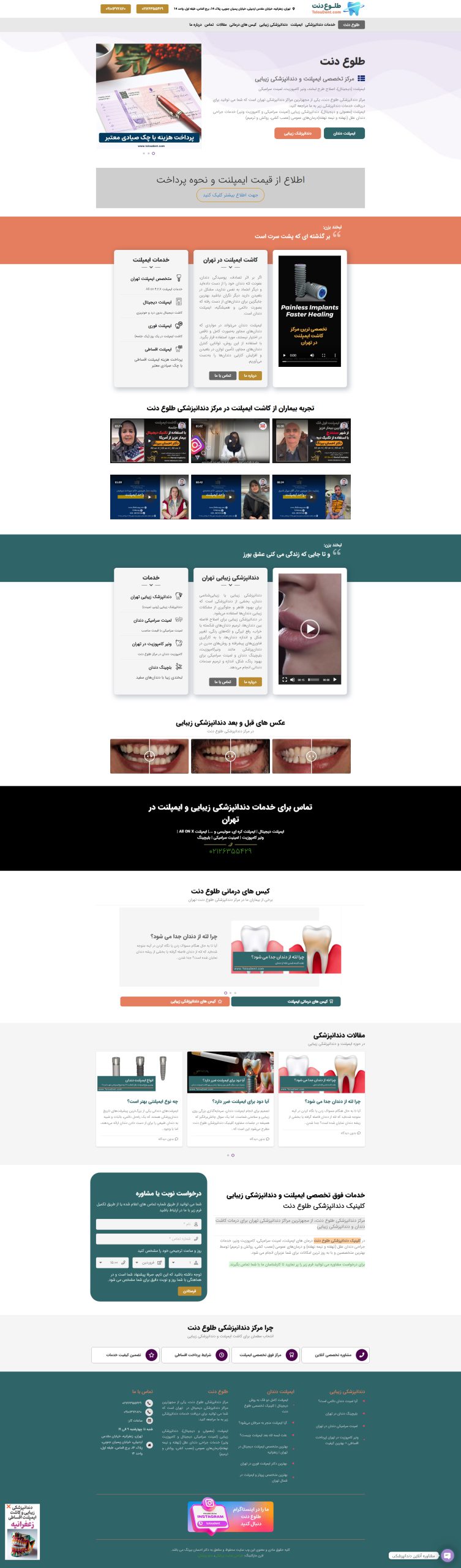 طراحی و سئو سایت طلوع دنت، مرکز تخصصی ایمپلنت و دندانپزشکی زیبایی در تهران